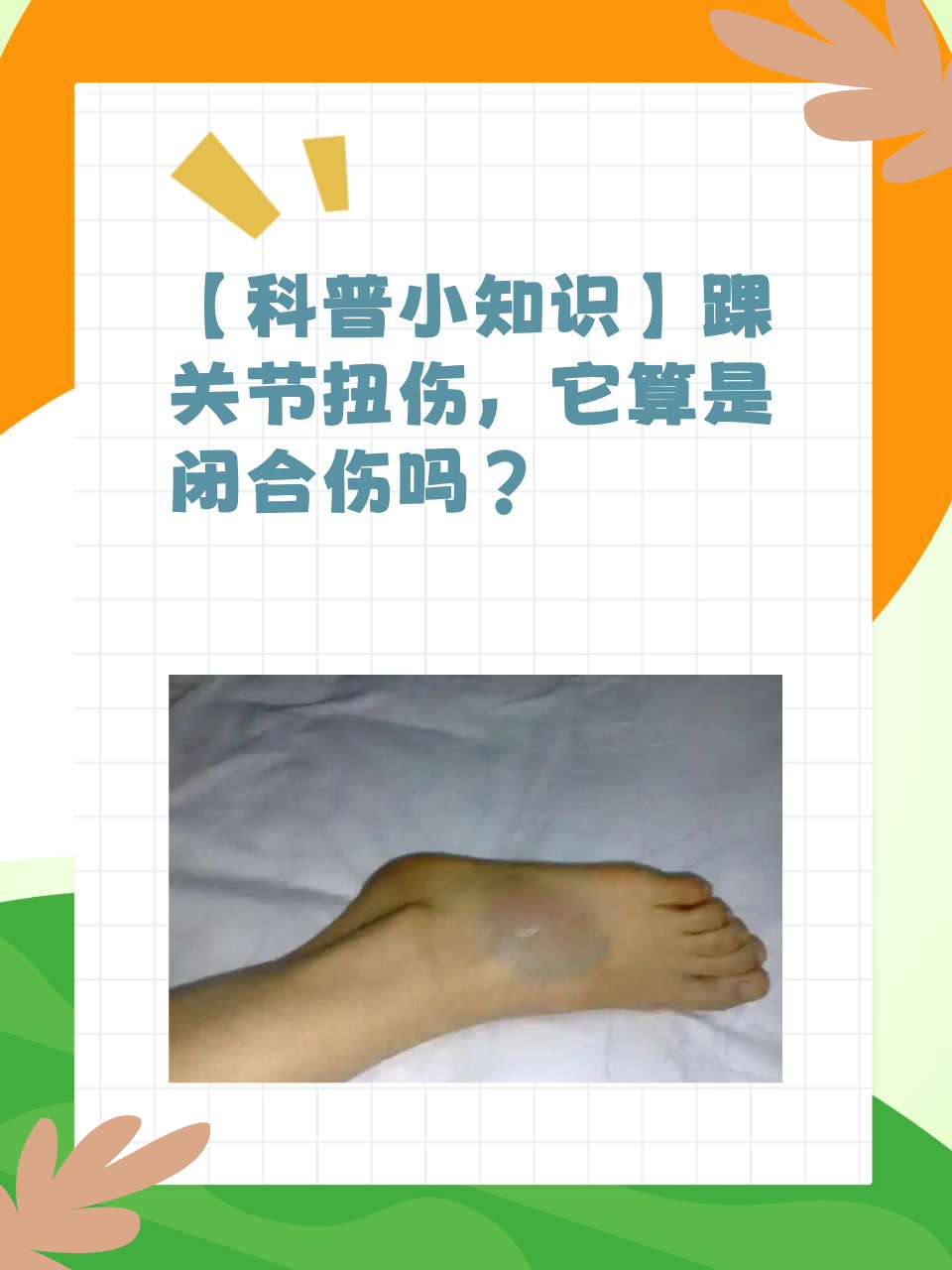 脚踝扭伤肿了怎么办?