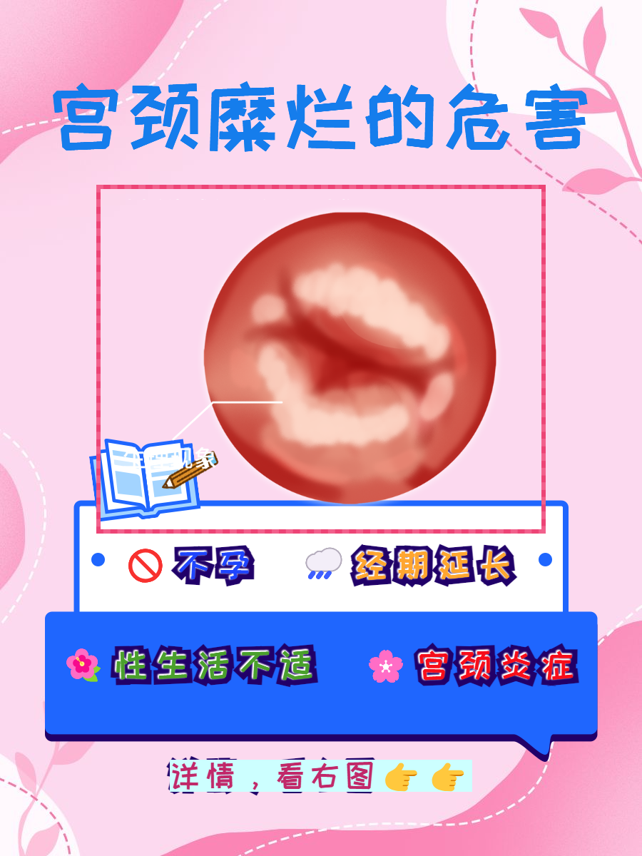 巢映菡 第2页