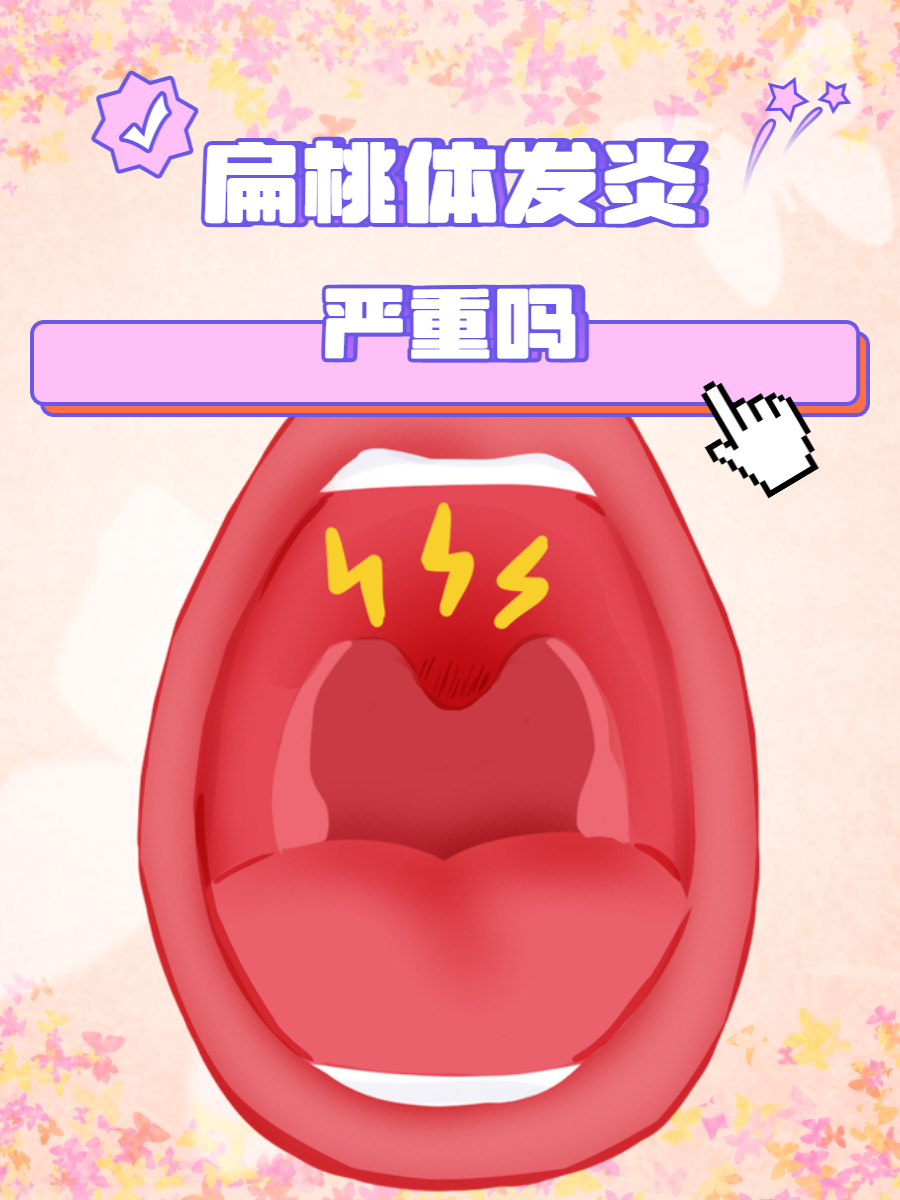 为什么会扁桃体炎