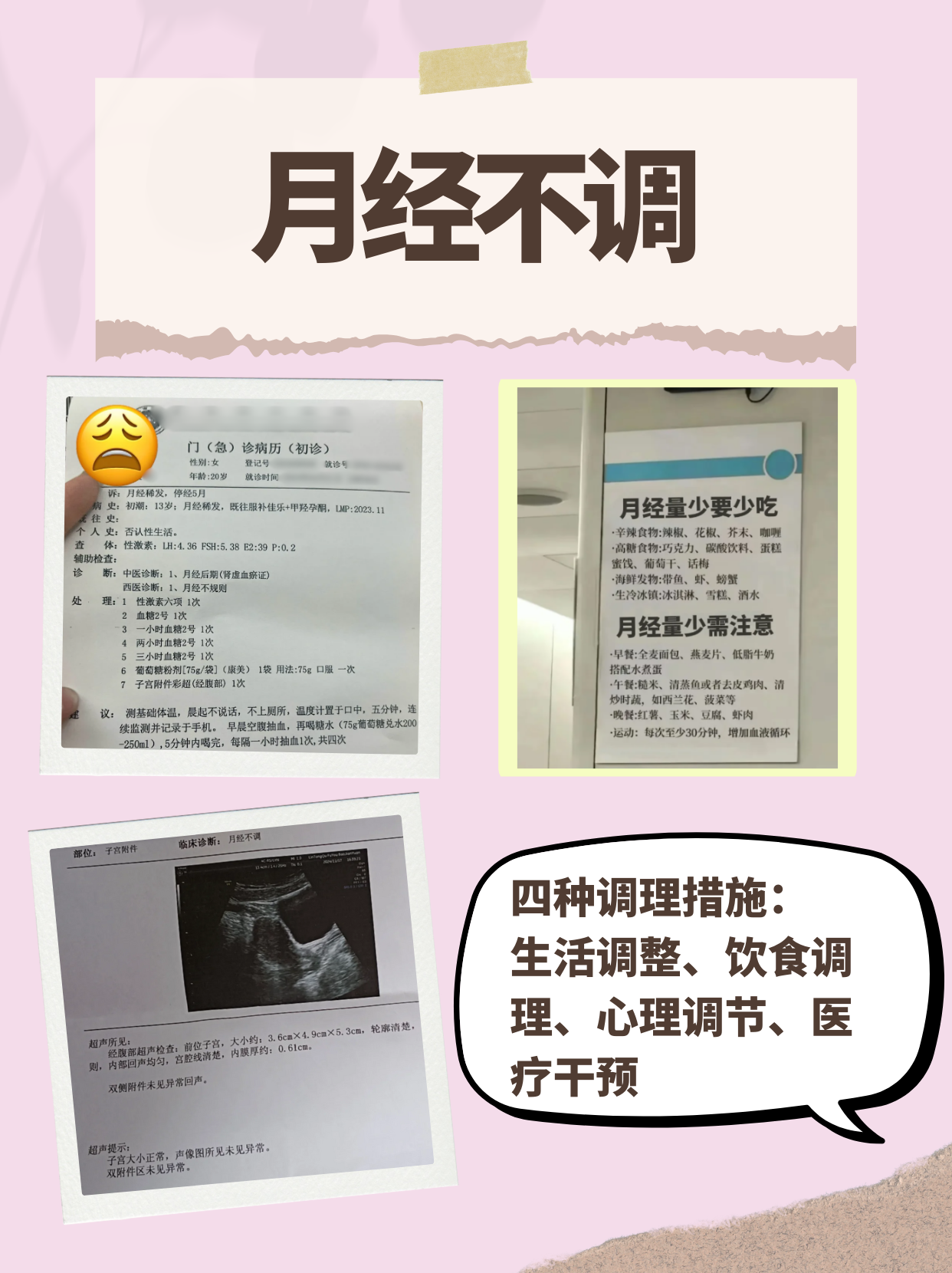 人流后月经不正常的原因
