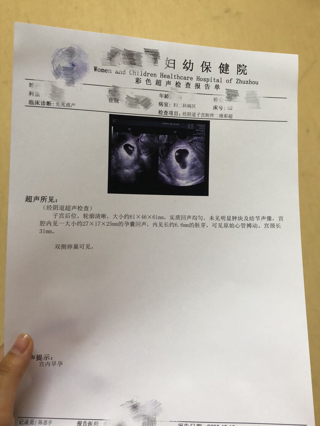 最晚什么时候有胎心胎芽