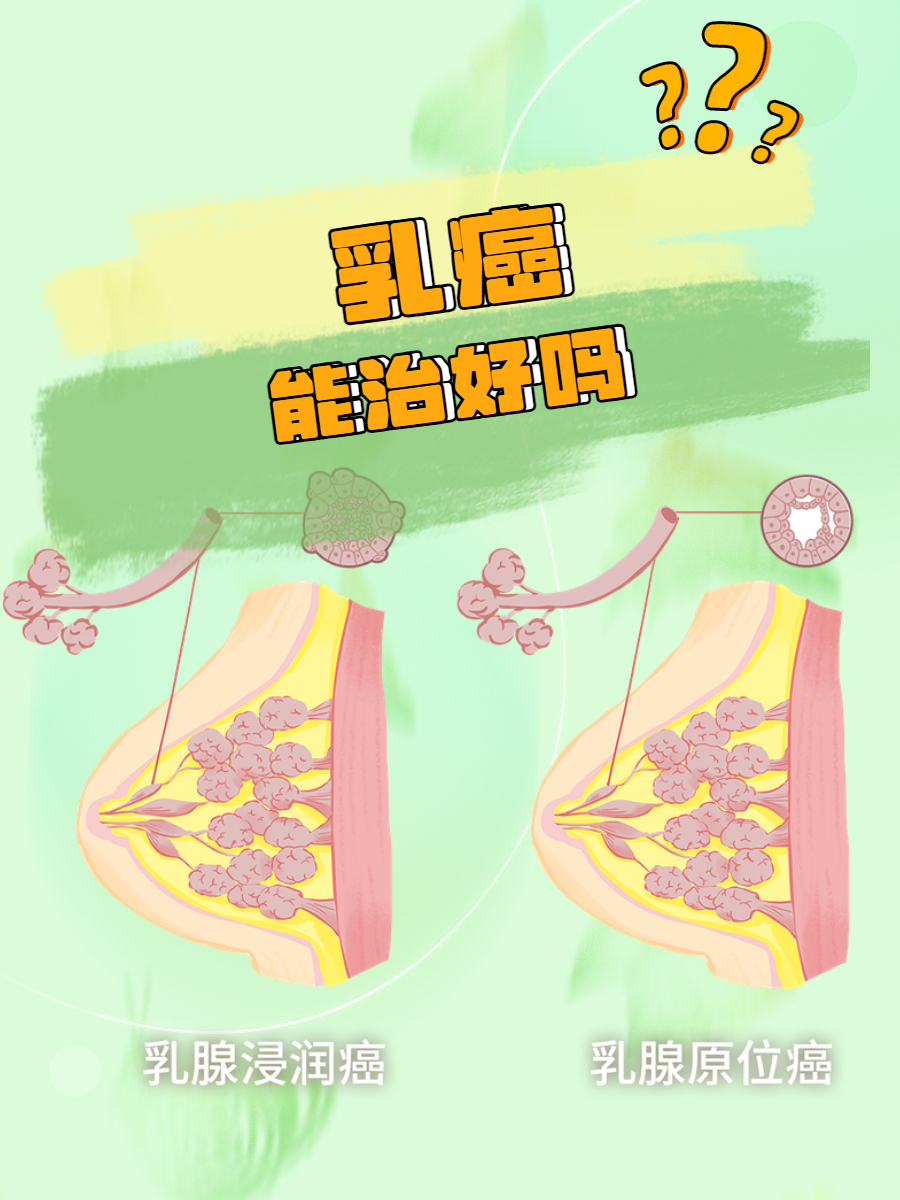 乳腺癌的形成原因有哪些