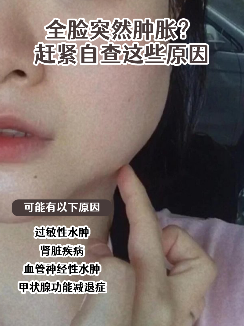 脸肿是什么原因引起