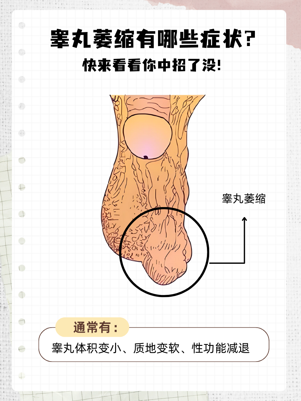 睾丸下垂正常吗