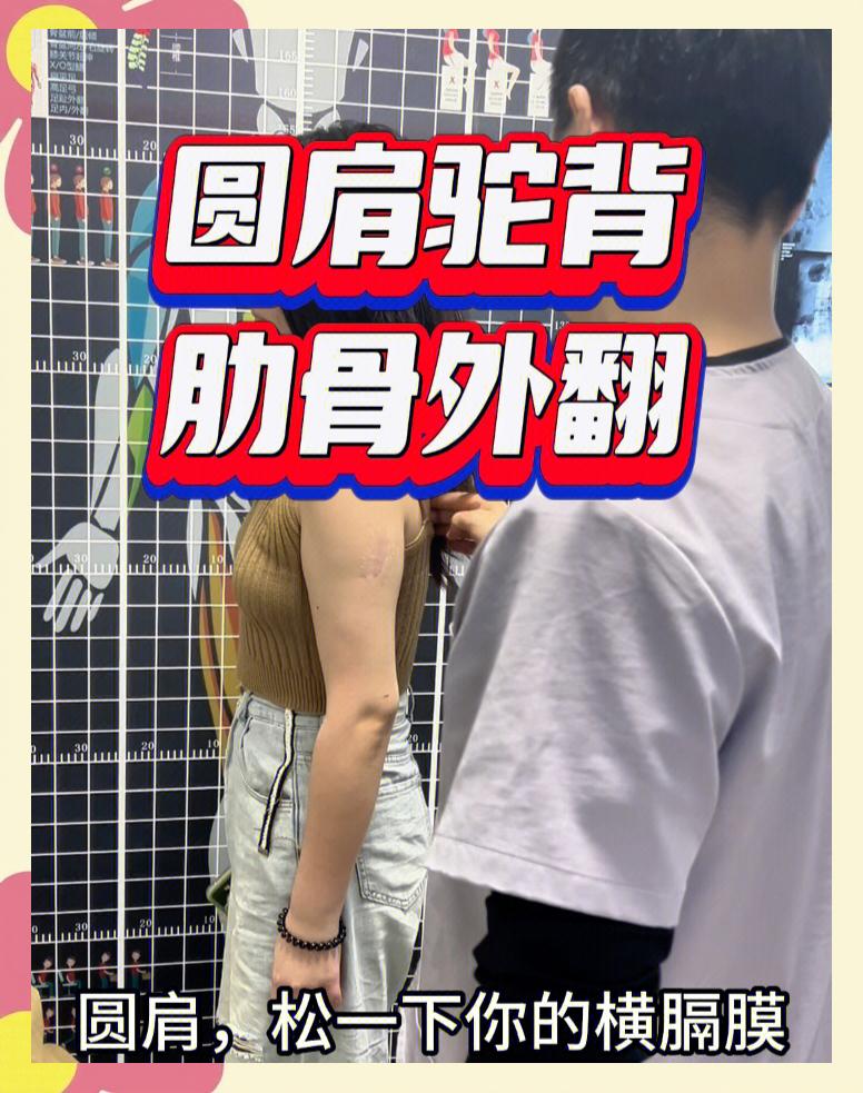 肋骨突出怎么治疗?