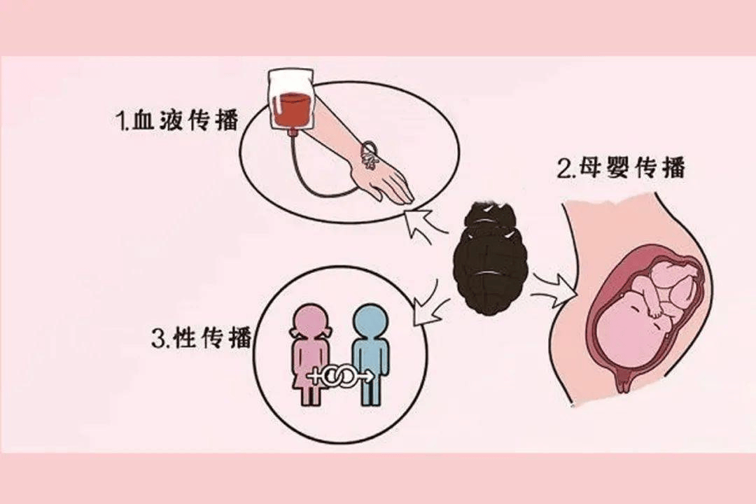 肝炎的传播方式