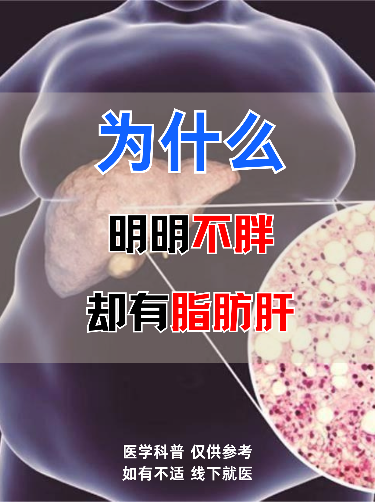 脂肪肝是有什么症状有哪些