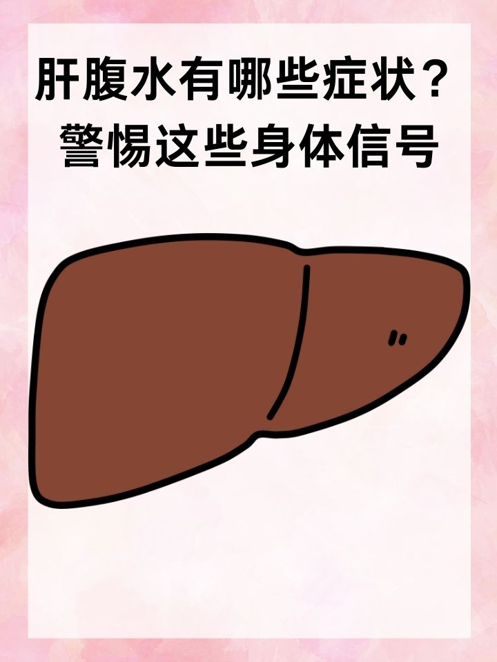 肝腹水表现症状有哪些