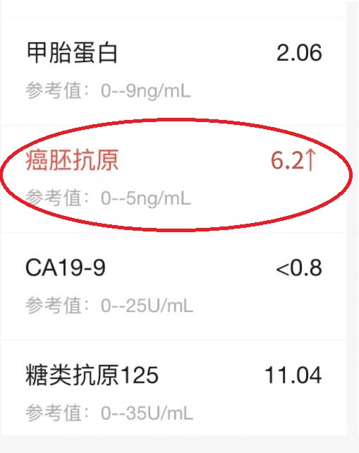 癌胚抗原测定