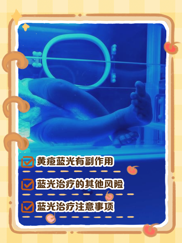 照蓝光对婴儿有影响吗?