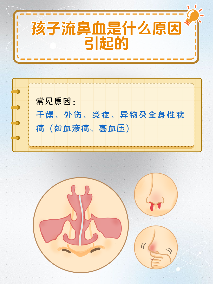 经常性的流鼻血是什么原因呢