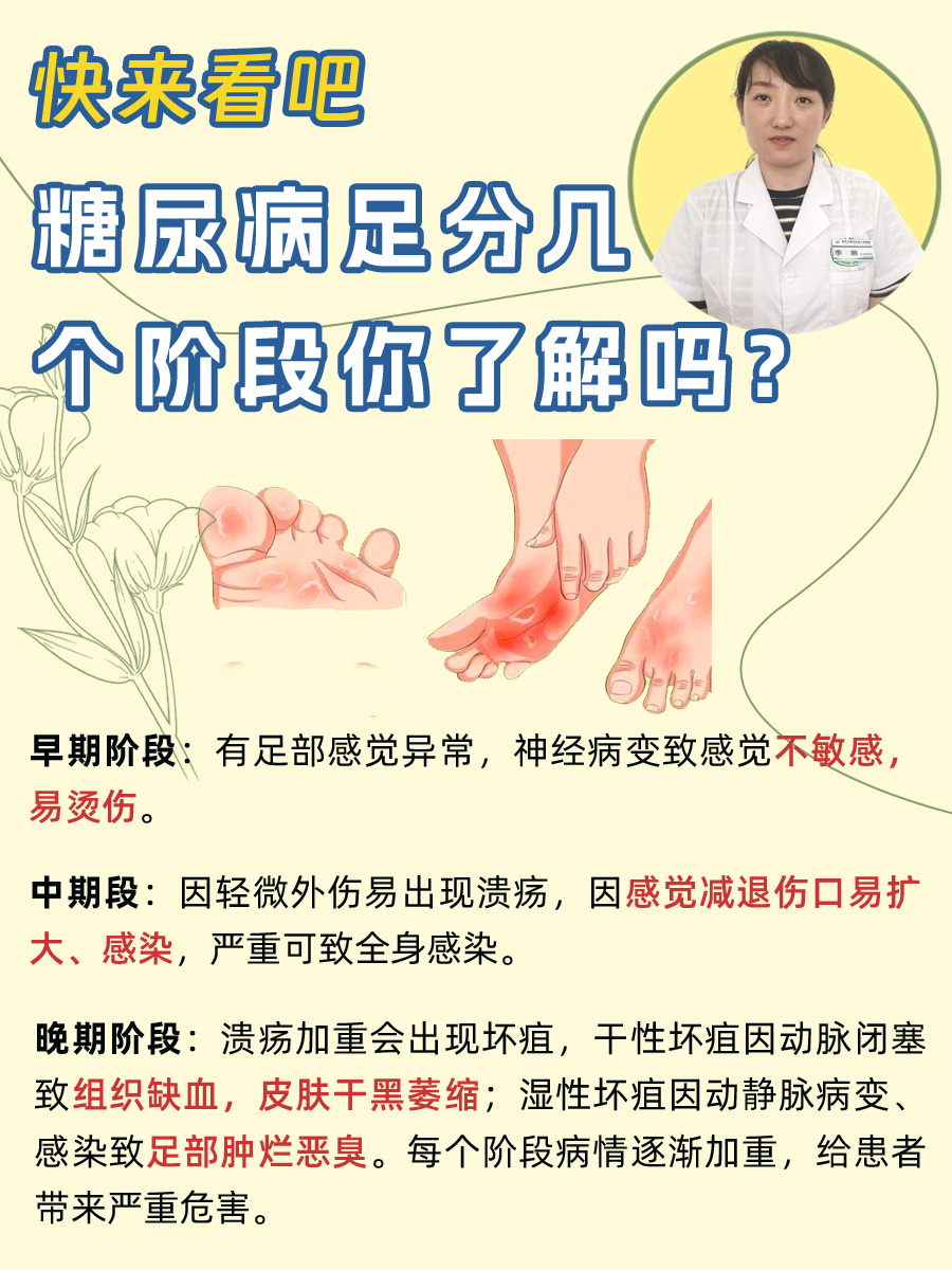 糖尿病足初期的症状有哪些