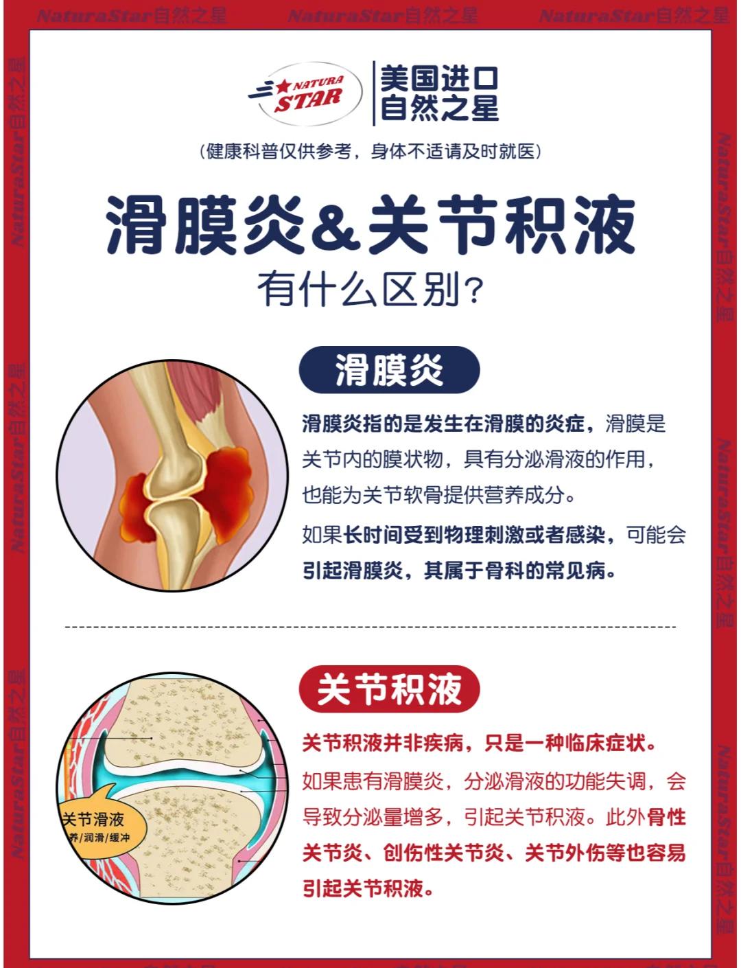 治疗滑膜炎的方法都有哪些
