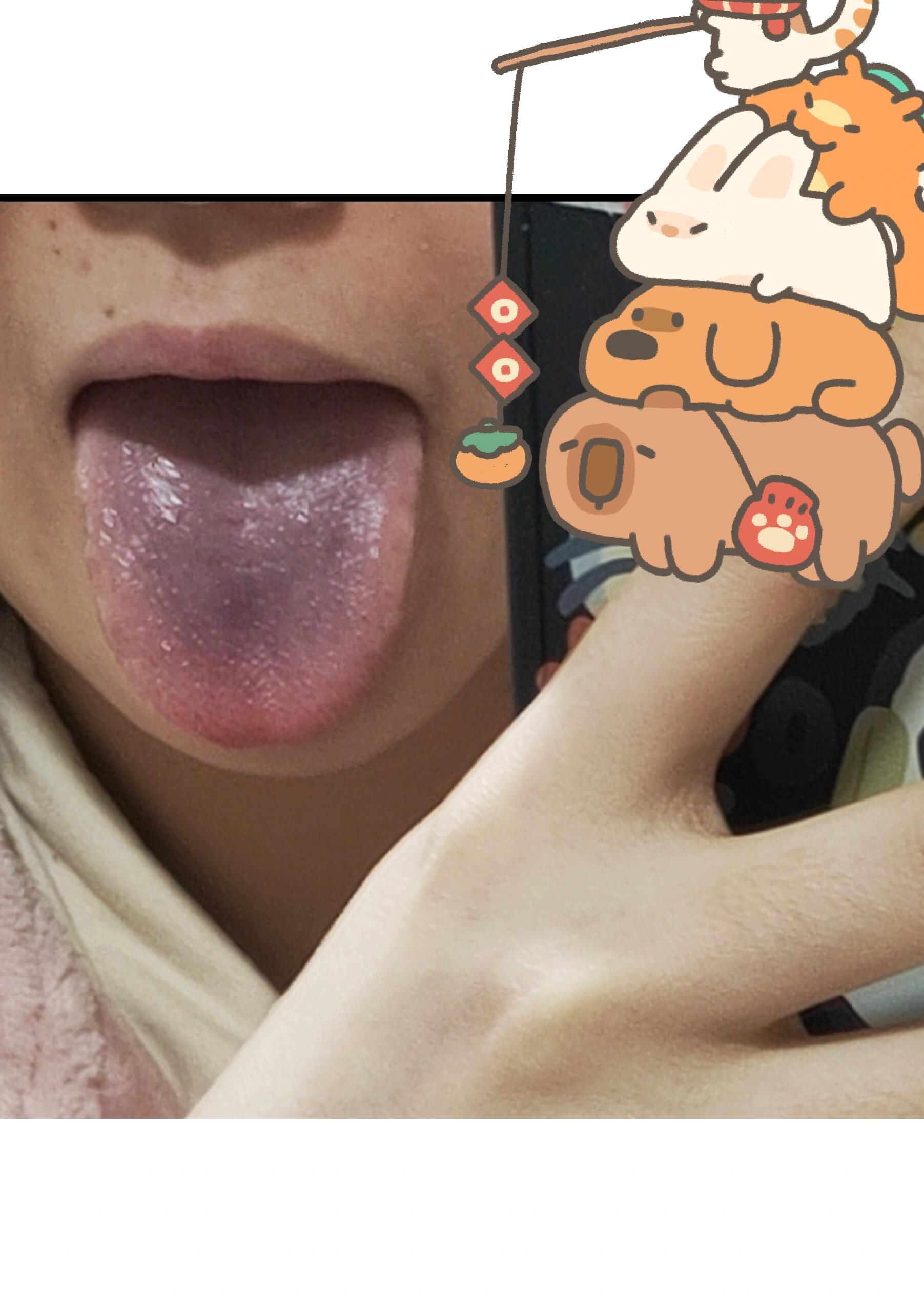 帮忙看看舌头的照片??