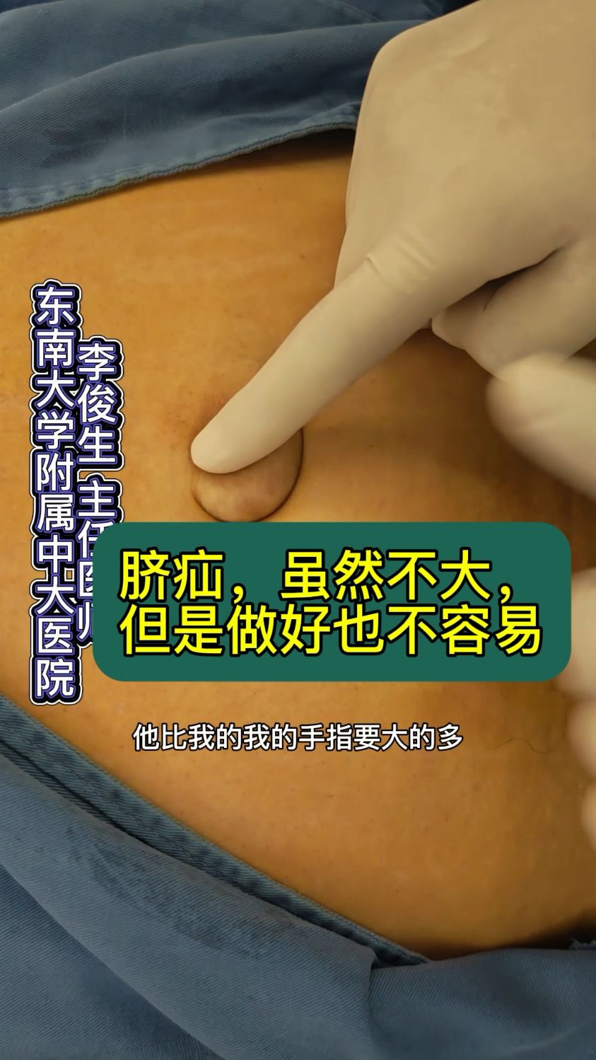 引起脐疝的原因有哪些