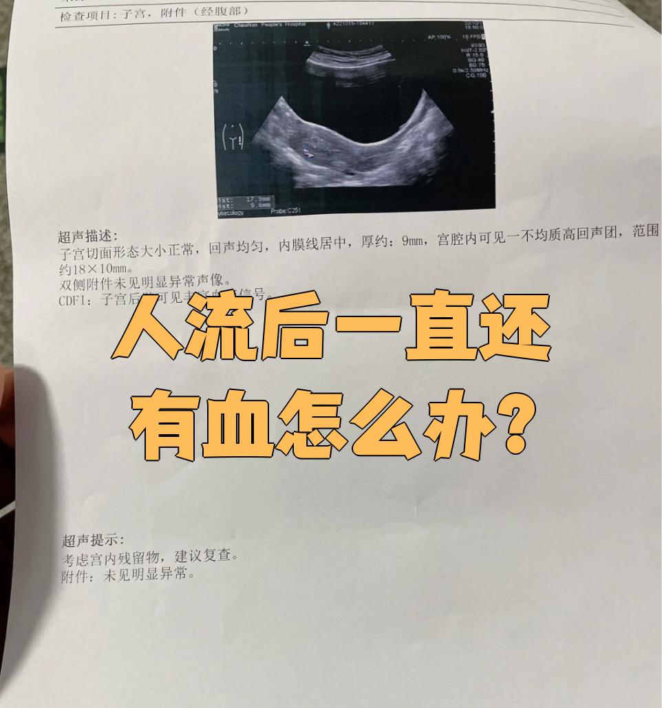 人流后没血正常吗