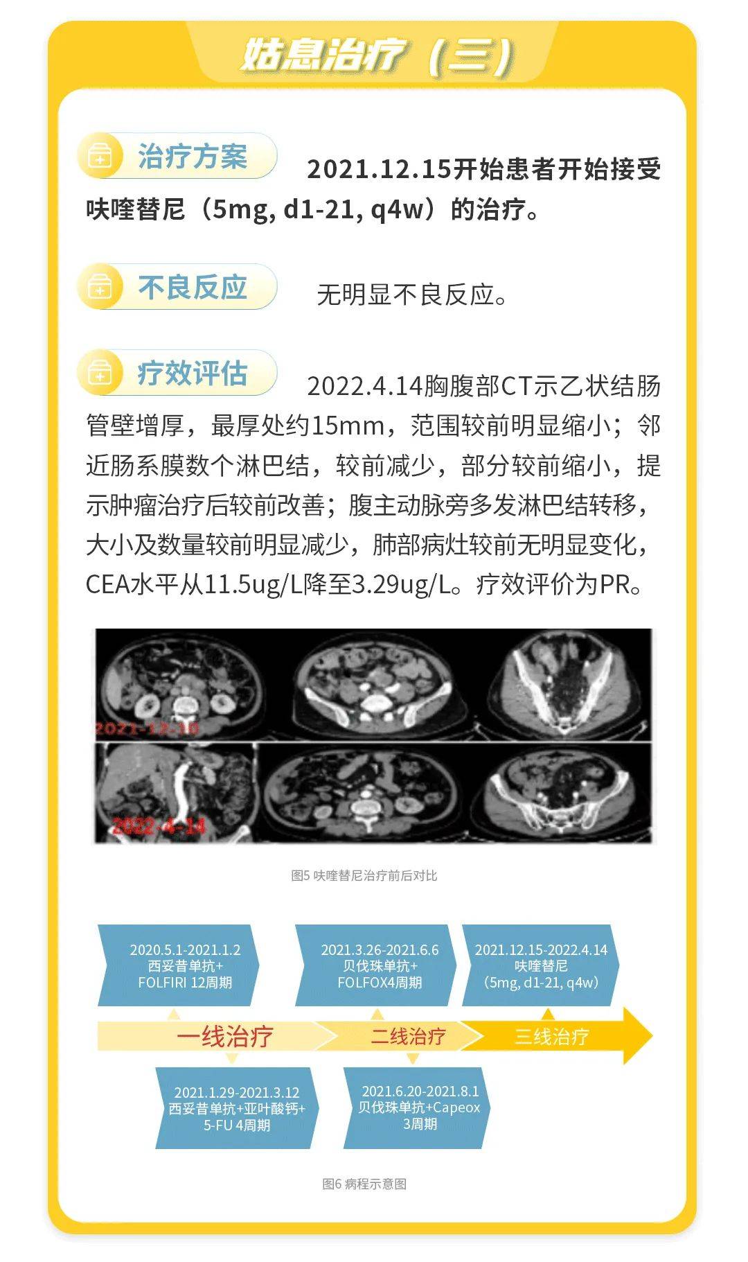 晚期肠癌能治好吗?