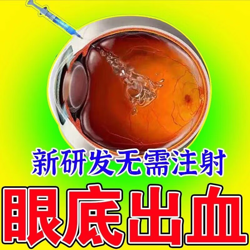 眼底出血吃什么药?