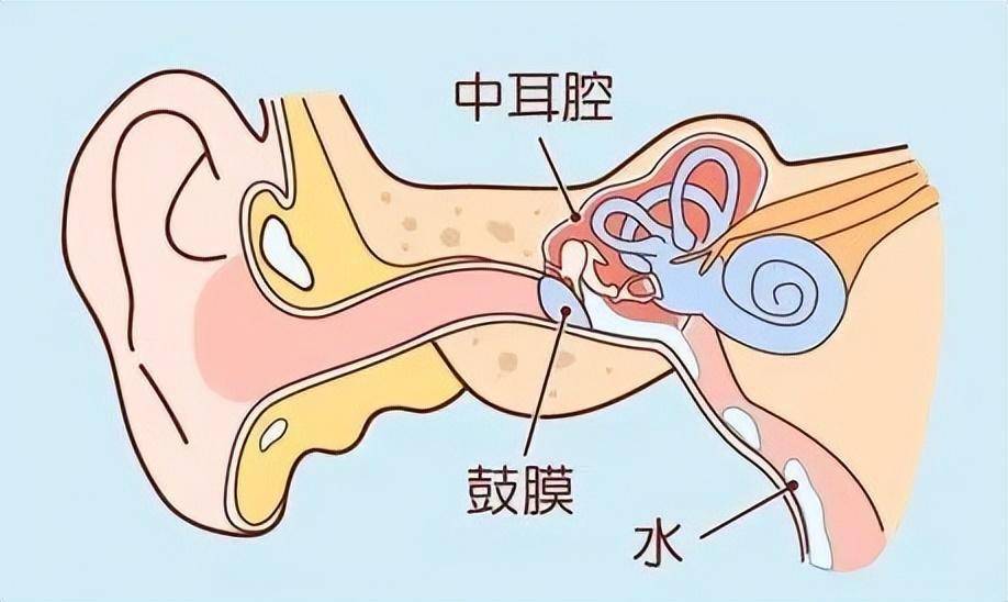 分泌性中耳炎怎么治疗好
