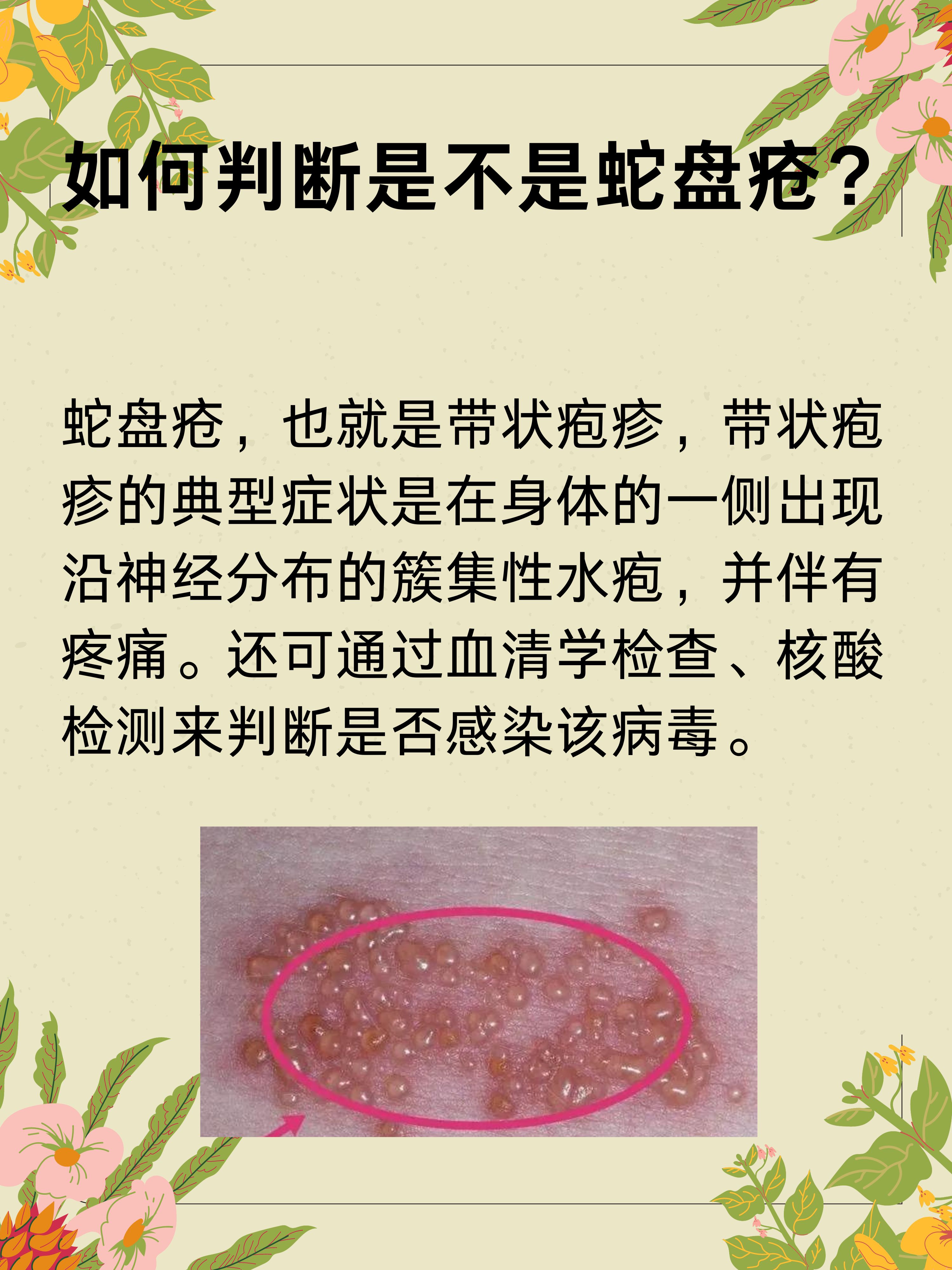 老鼠疮是什么病,该怎样治疗