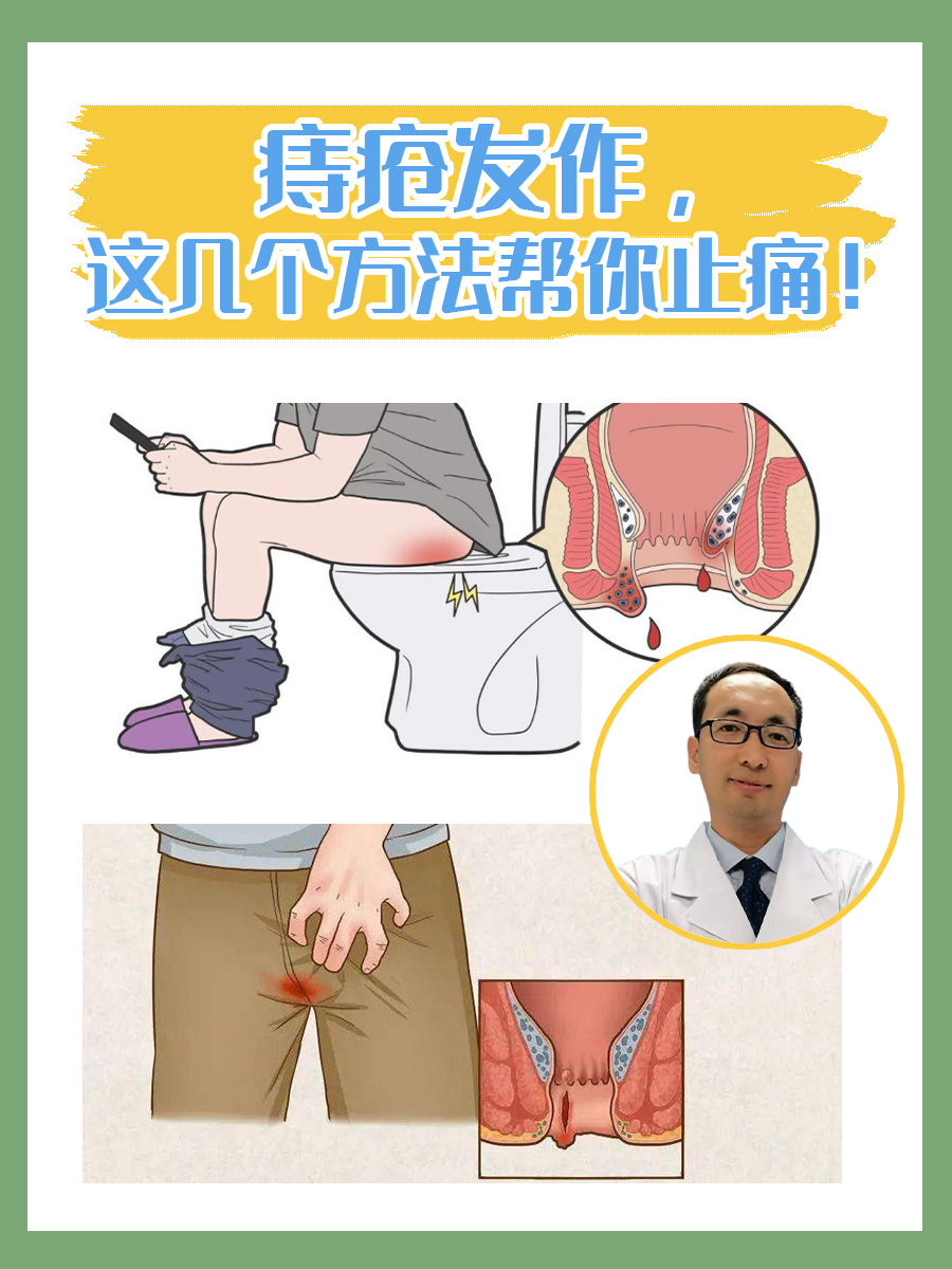 痔疮痛的睡不着怎么办