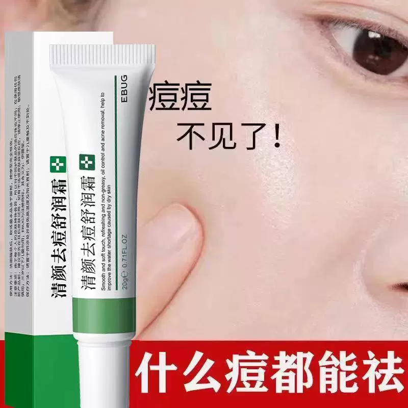 脸上长痘痘吃什么药