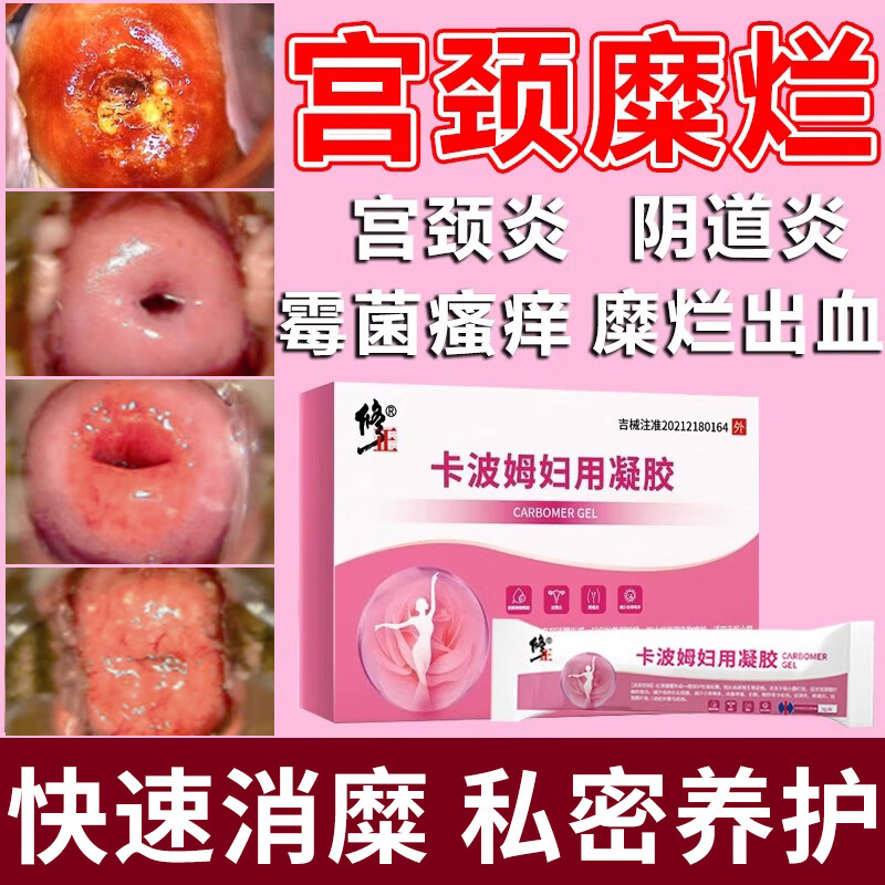 宫颈糜烂3度怎么办
