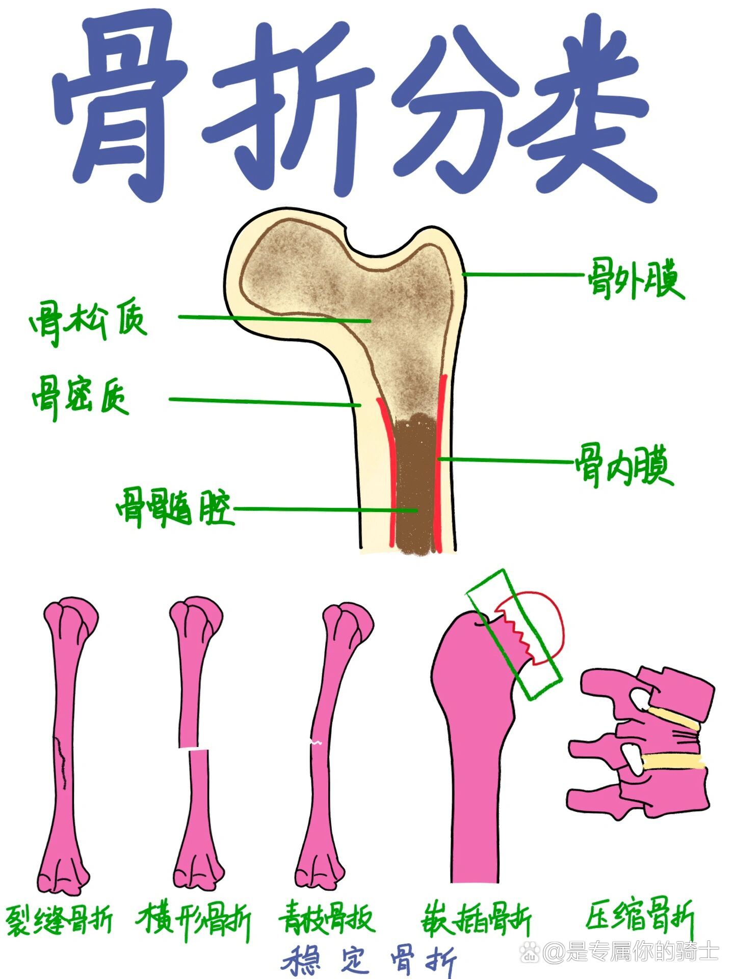骨折与骨裂的区别有哪些