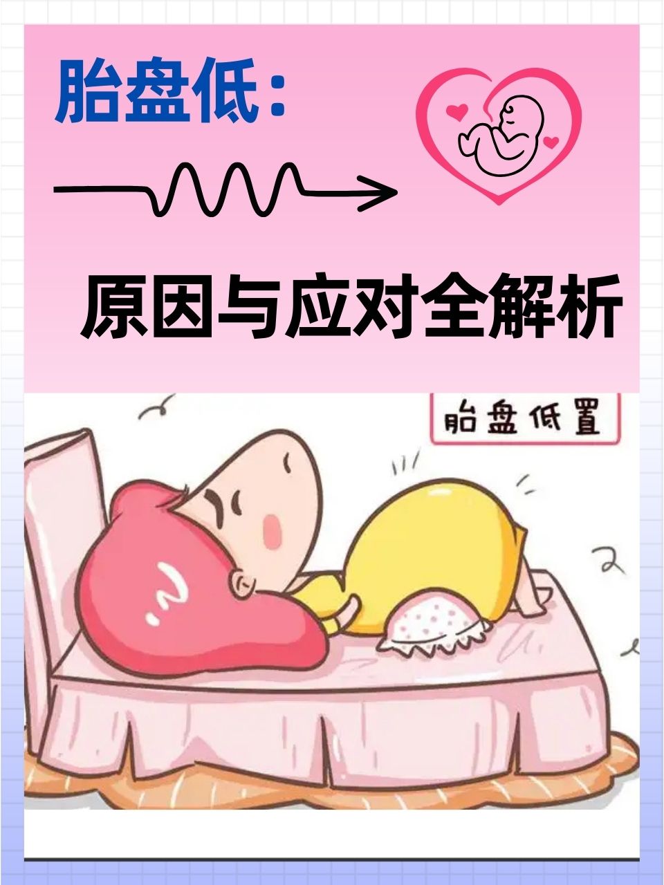 前置胎盘的病因有哪些