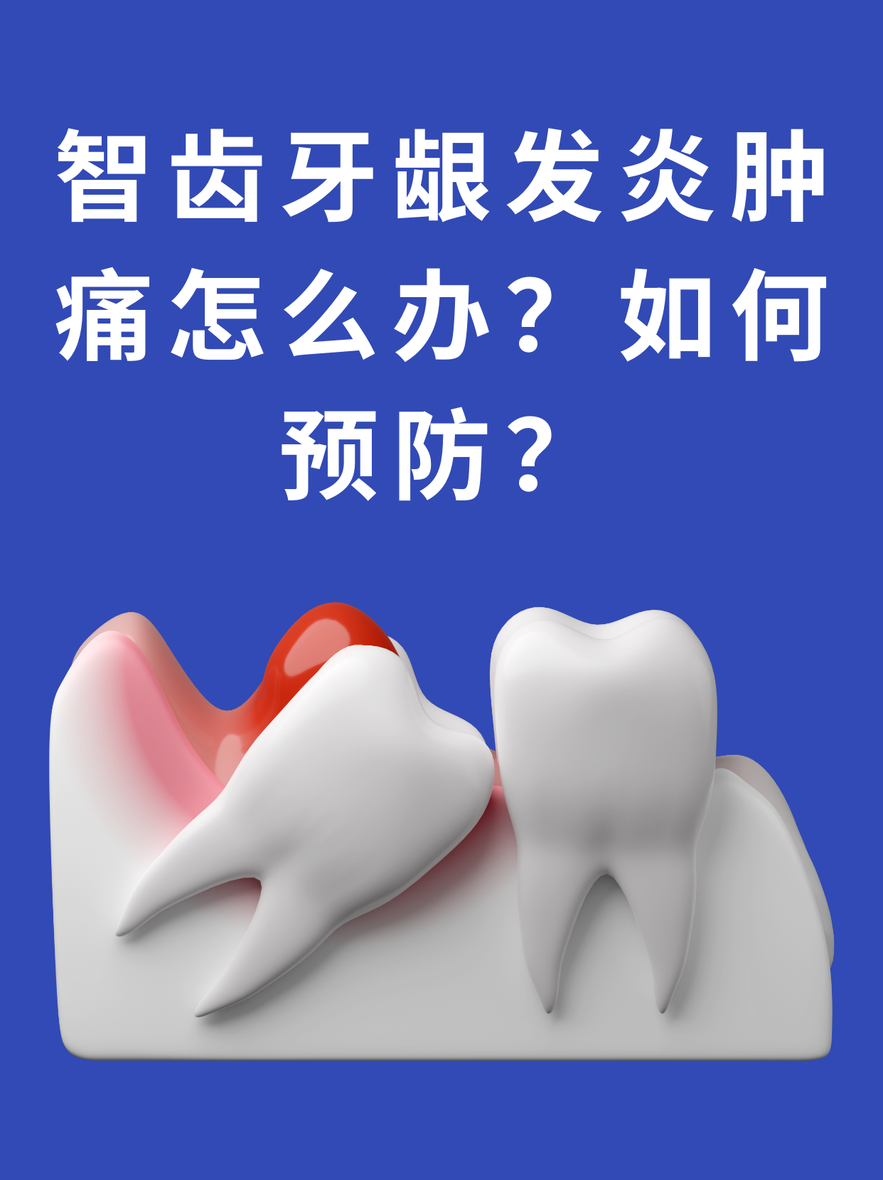 牙龈肿胀疼痛是什么原因