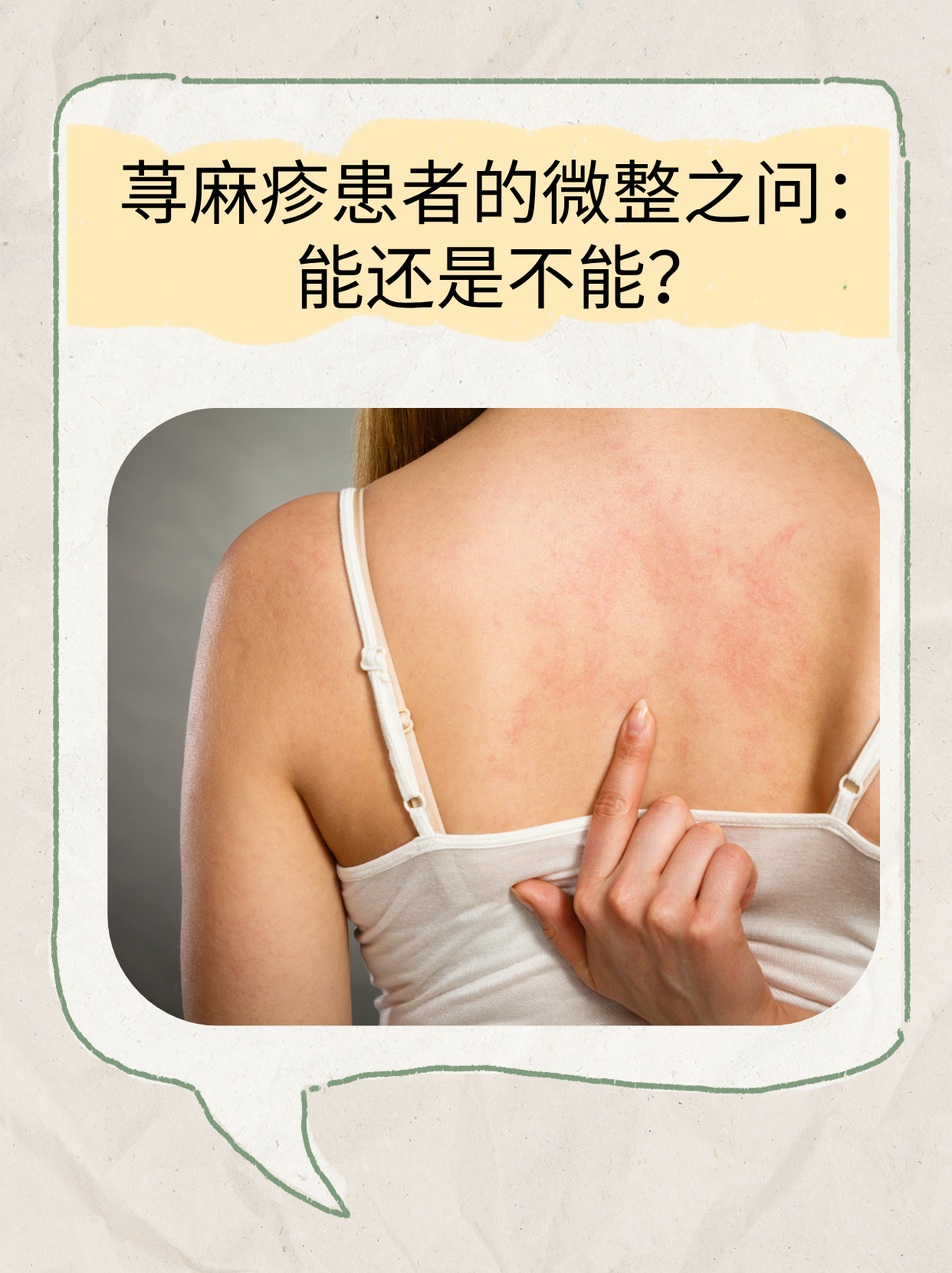 荨麻疹的治疗方法有哪些?