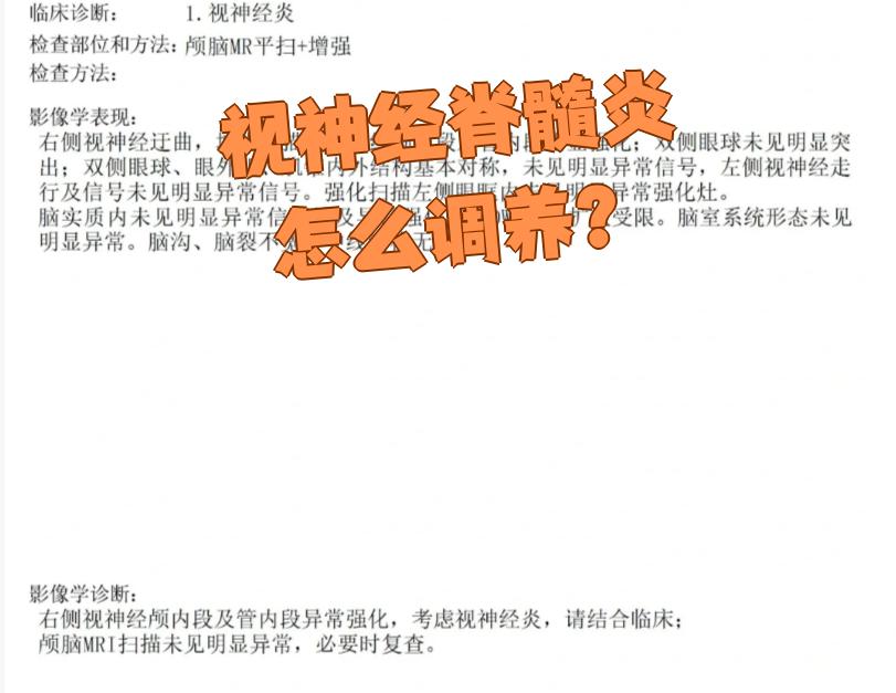 视神经性脊髓炎什么病