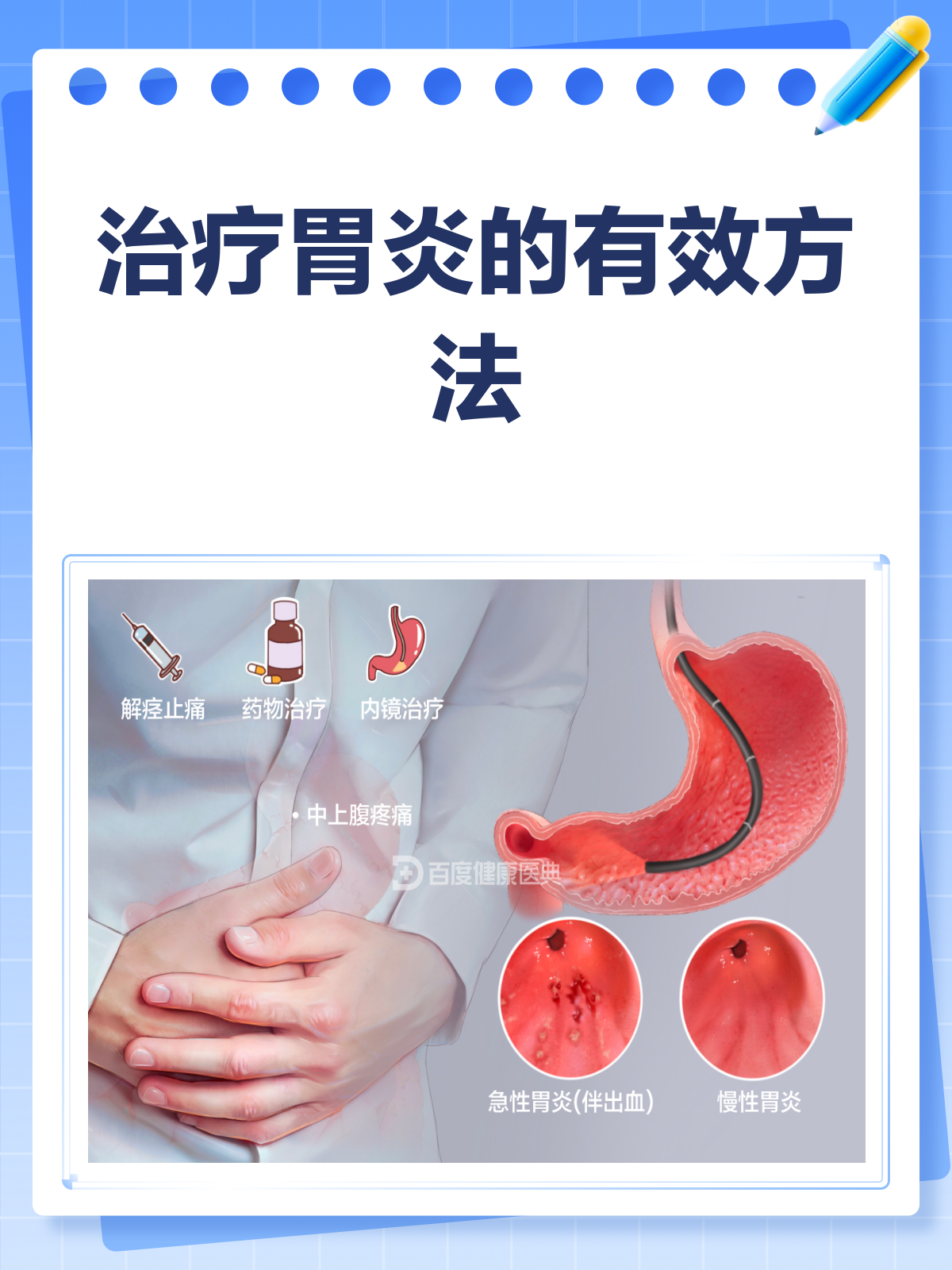 胃炎如何治疗