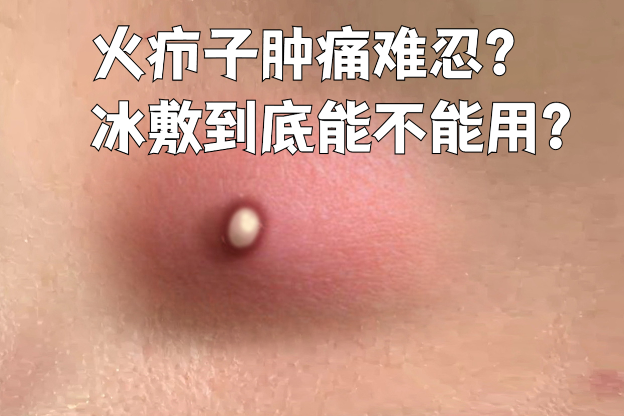 疖子怎么治