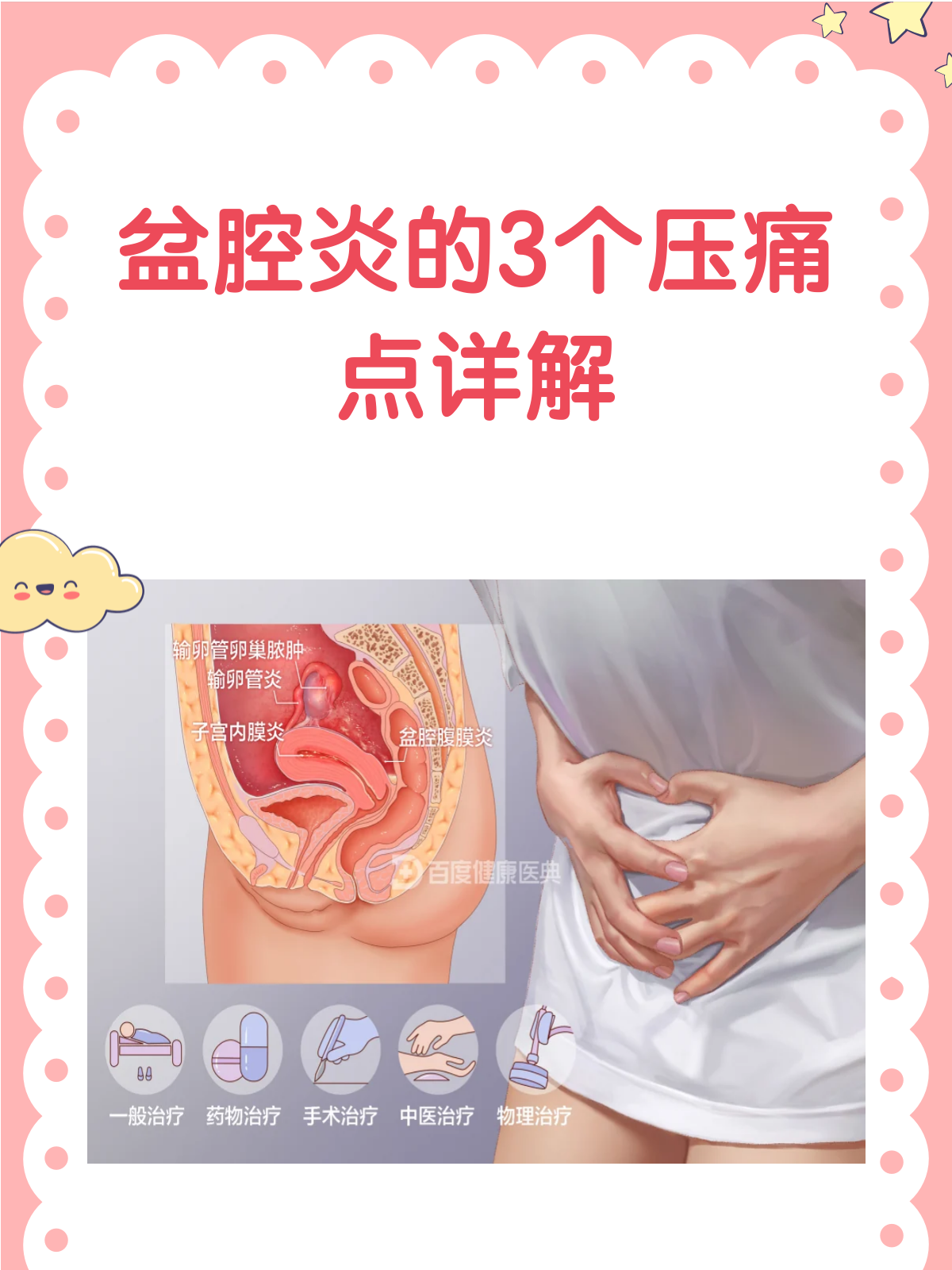 盆腔炎是什么?