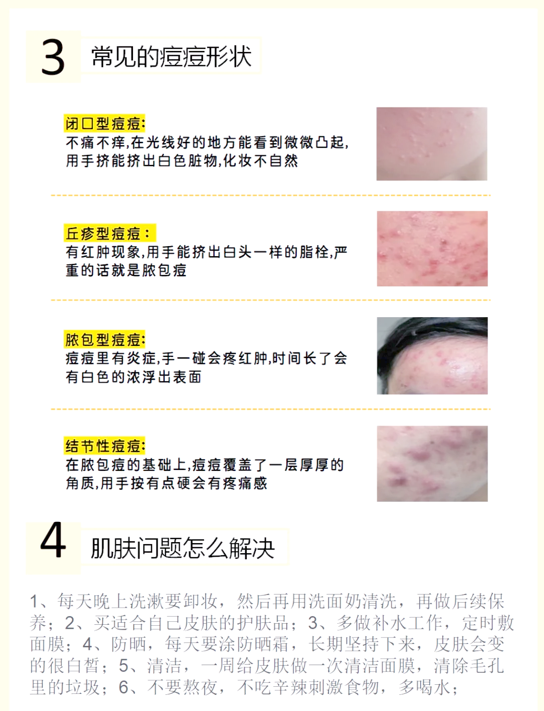 毒疖子和疖子区别从疾病的症状表现就可以区分
