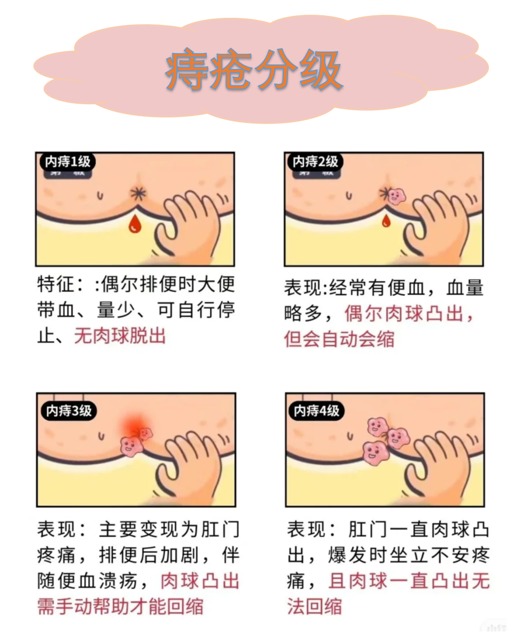 痔仓是怎么出来的