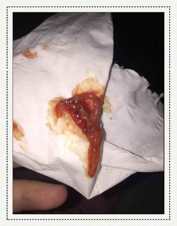顺产恶露多久排干净