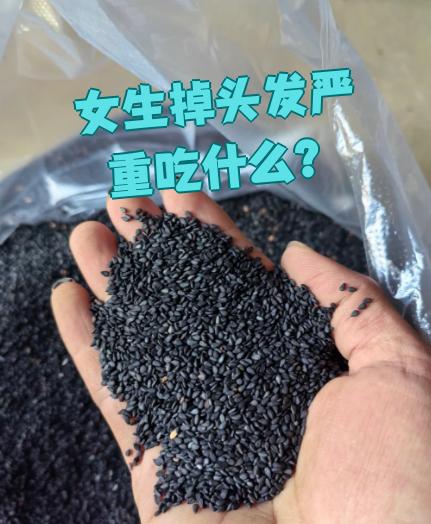 女性脱发吃什么好呢?