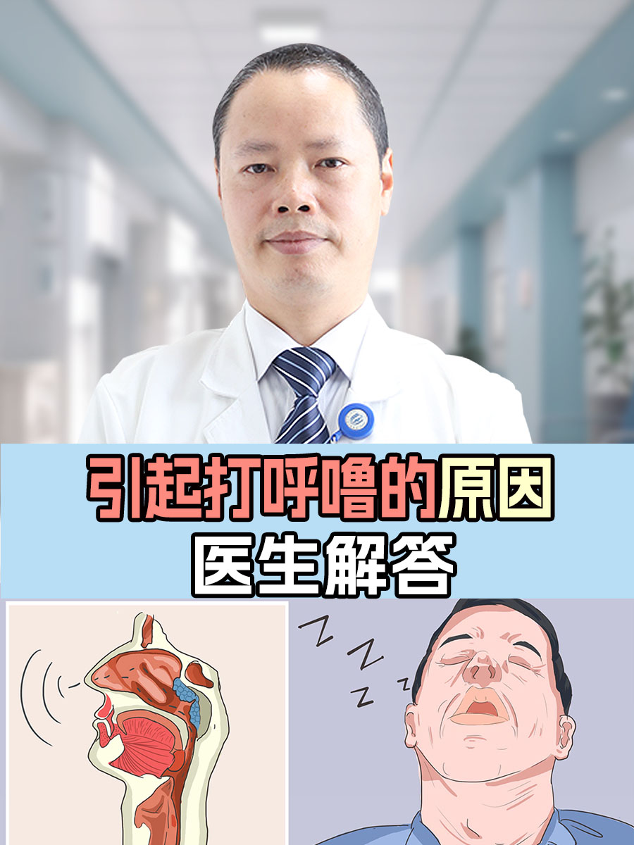 打鼾的原因及治疗方法