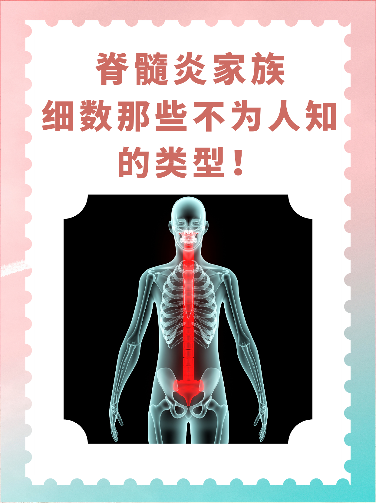脊髓炎是怎么引起的