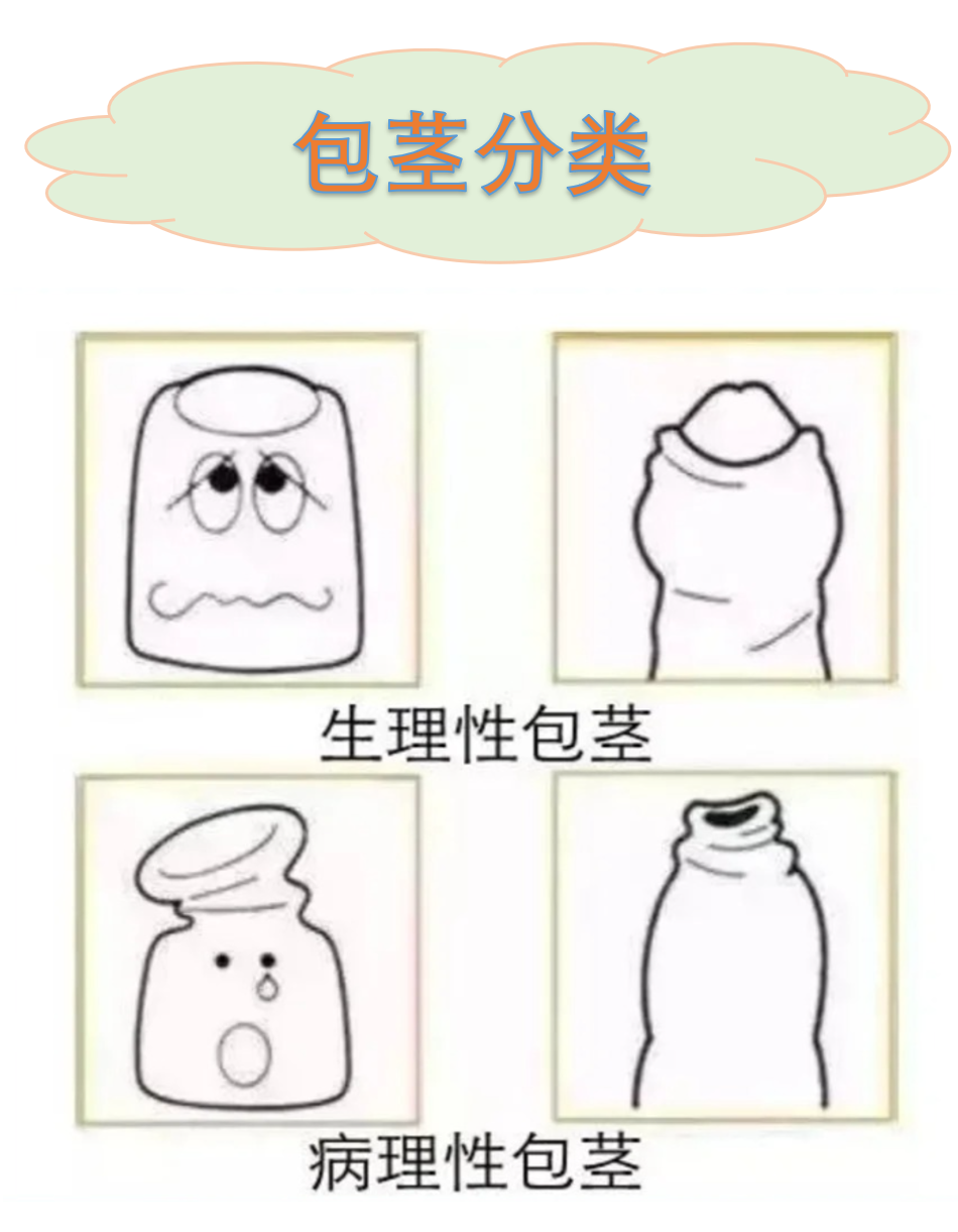 怎么算是包皮过长