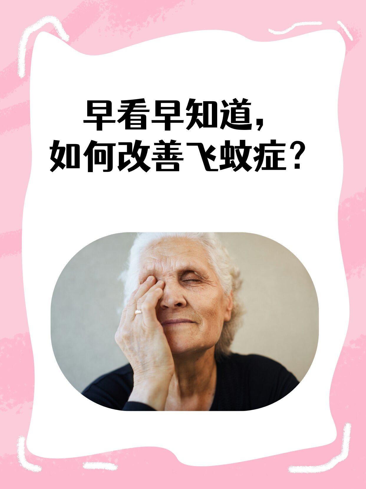 眼睛飞蚊症能自愈吗