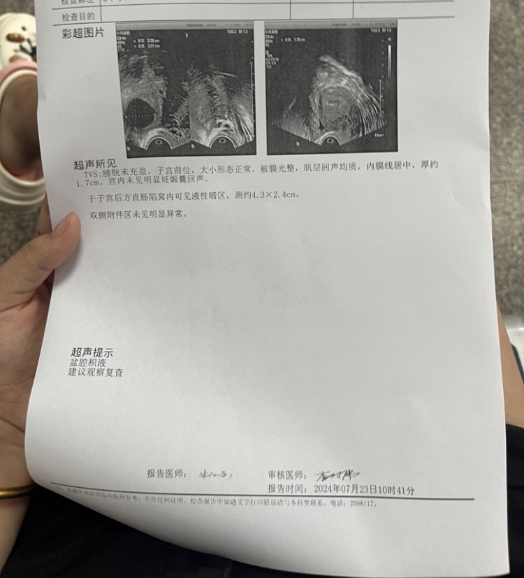盆腔积液怀孕几率大吗