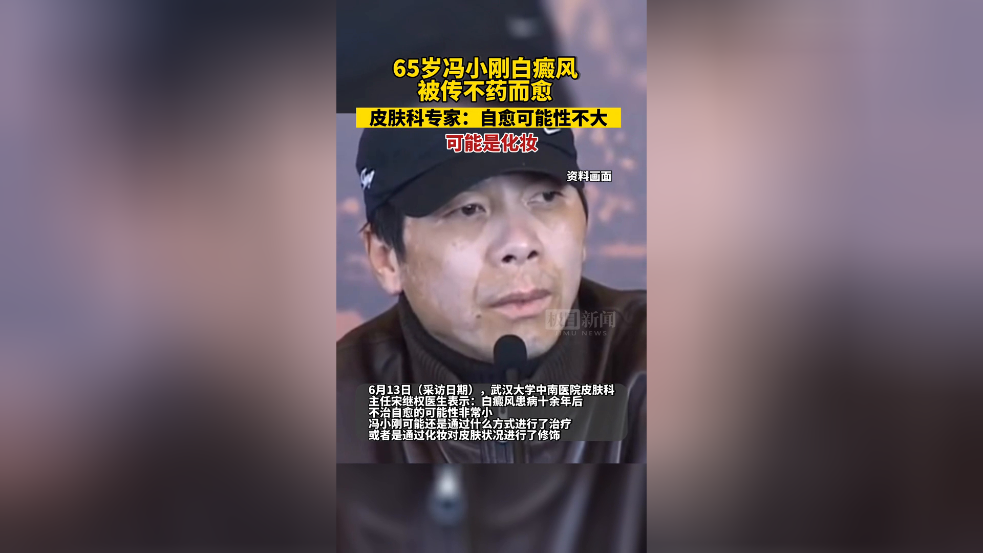 冯小刚白斑自愈了