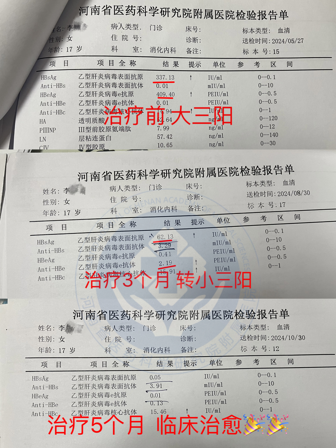 乙肝大三阳能转阴吗?
