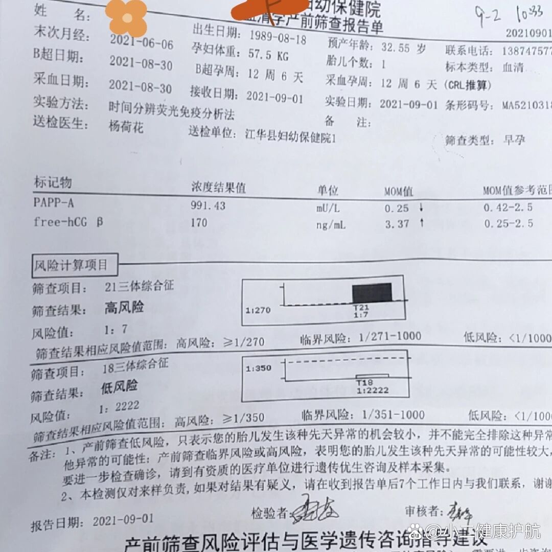 21三体综合症高风险是什么意思
