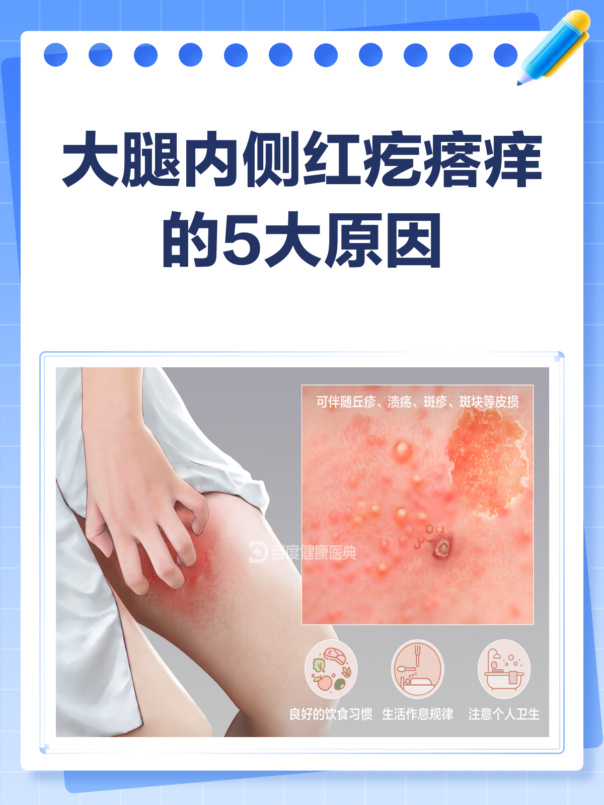 大腿内侧瘙痒什么原因