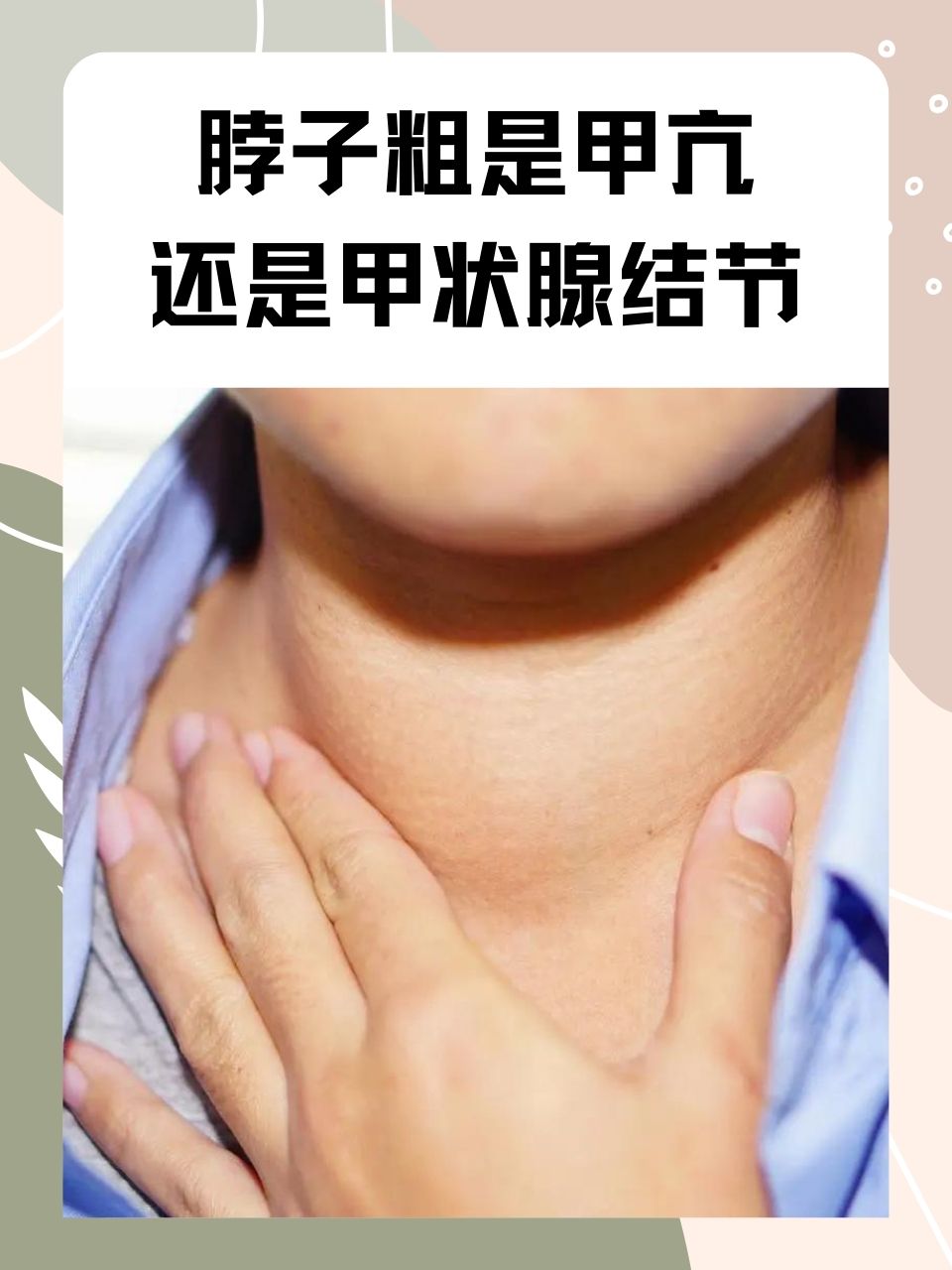 甲状腺结节会癌变吗?