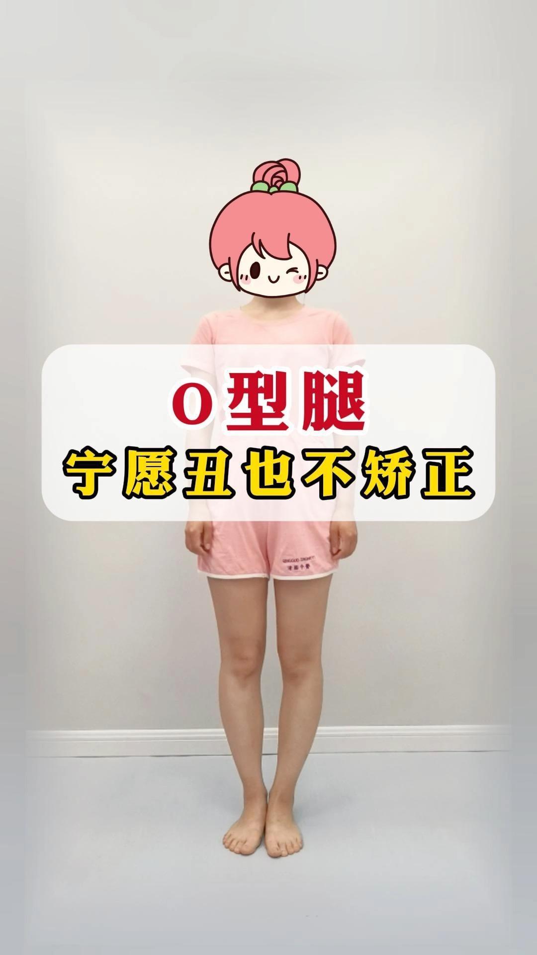 怎么才能矫正O型腿